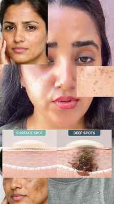 POV: Your skin starts looking brighter and people actually n
