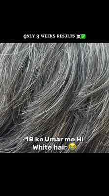 Grey hair solution comment for link 🔗 directly buy bhi kar 