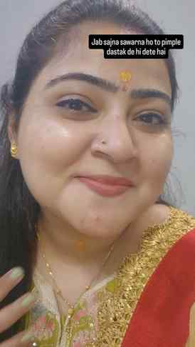 Ye Pimple v na bemausam nikal jata hai

#sawan #trend #fyppp