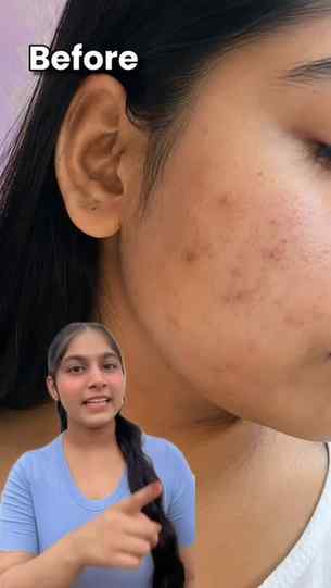 The Derma Co. 1% Kojic Acid Face Wash helps target dark spot