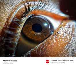 Magic of macro photography
Shot on Xiaomi 15 ultra
#Xiaom