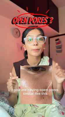 മൃദുവായ ചർമ്മം = Less Visible Pores 👀
Visible pores, oily