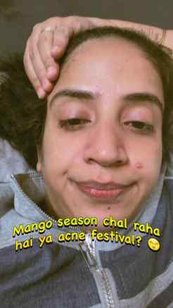 Meetha aam, kadwa result 😭