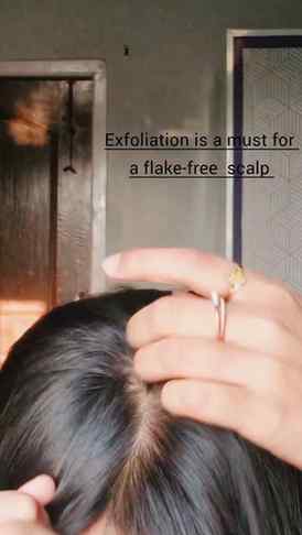#Ad Your scalp goes through a lot daily 💦😅
Dust, sweat, po