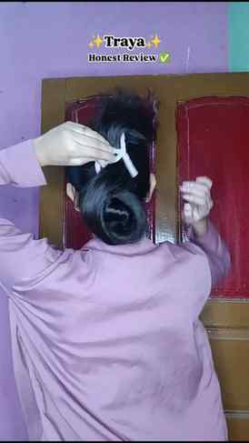 Dandruff hairfall ka ek major reason ho sakta hai.
Especiall
