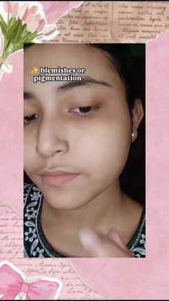 @joveesherbal Ayurvedic Anti blemish pigmentation cream 💧
.