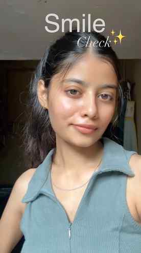 smile check passed? 🥹✨
smile check trend, natural smile, so