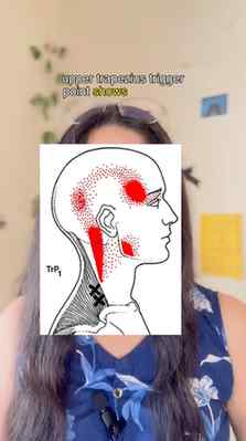 Trigger point / tendon point 💪🏻

#triggerpoint #physiowort