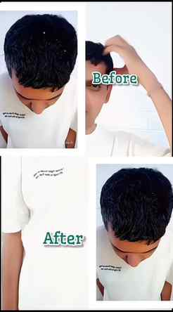 Your scalp is an extension of your skin, so why aren’t you t