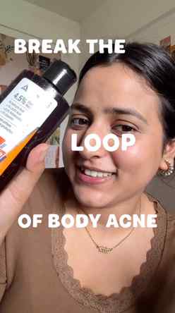 #AD Myth: once acne clears, it won’t come back. Truth: if yo