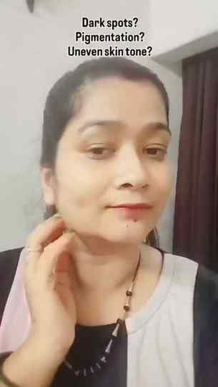 Dark spots aur pigmentation se pareshan ho? 💙
Try The Derm