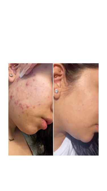 Oily skin, meet your lightweight hydration fix 💚 Plum SebaC