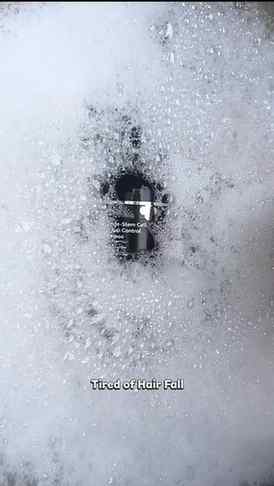 Say goodbye to hair fall! β¨π§¬ This Peptide & Stem Cell formu