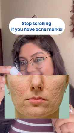 Nighttime is when your skin does its best repair... so why n