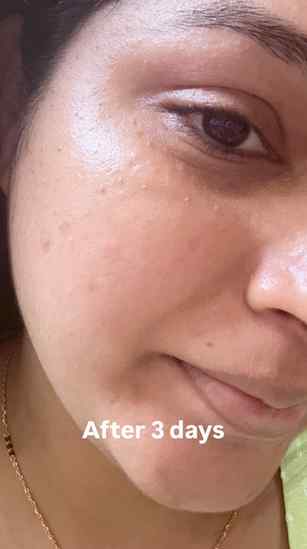 Pigmentation, dark spots आणि uneven skin tone ला bye bye! ✨�