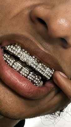 Comment “Grillz”