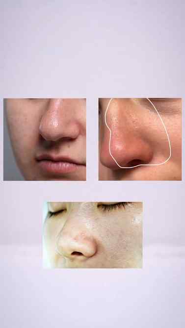Clearer-looking pores, cleaner nose β¨π€
A little self-care m