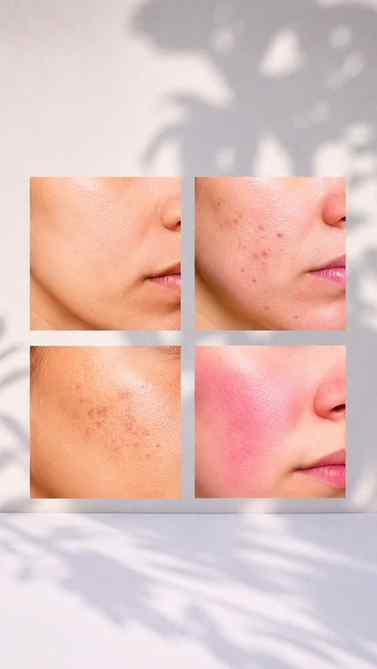 β¨ Vitamin C glow, but make it skincare! ππ
Brighter-lookin