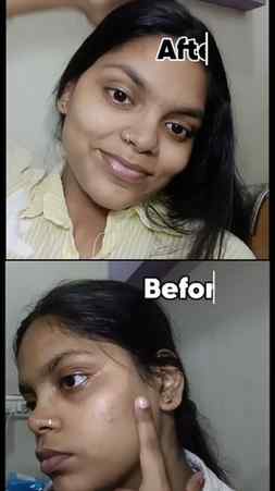 My go to pimple treatment ..
No #ad