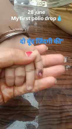 My first polio drop 💧.......