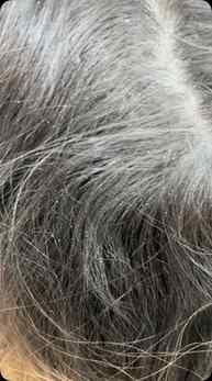 Dandruff, flakes & itchy scalp? 🫧✨
Meet my haircare essenti