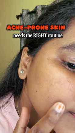 POV: your skincare routine finally started making sense ✨🧴
