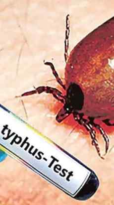 All you need to know about scrub typhus.
.
.
.
#scrubtyphus