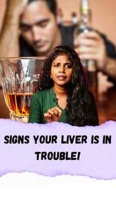 Signs of liver damage for alcoholic's
.
.
.
.
#alcohol #live