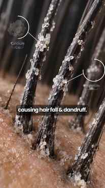 Why let hard water take a toll on your hair when one shampoo