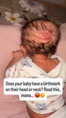 Seeing a new mark on your newborn’s skin can bring up so man