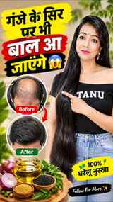 Gange Ke Sir Par Bhi Baal Aa Jayenge 😱😱
Full Recipe captai