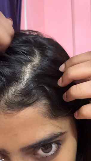 Flake-free days start with the right scalp care! 🧖♀️ Keepi