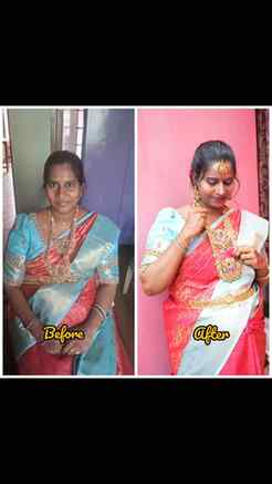 ✨ A Glow That Speaks Elegance! ✨

A beautiful Before & After