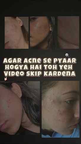 Dm me for link 🔗
#viral #trending #reels #explore #ugc