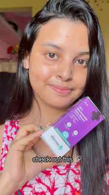 Acne marks have been one of my biggest skincare concerns, an