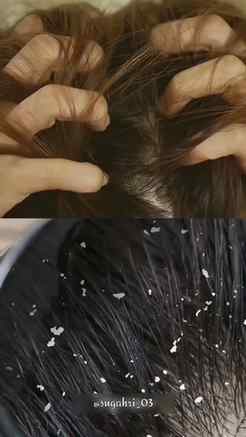 #Ad
Your scalp is an extension of your skin, so why aren’t y