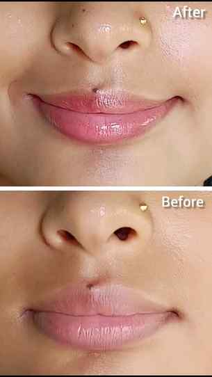Sun protection isn't just for your skin—your lips need it to