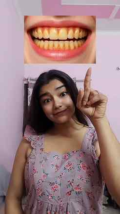 That yellow stain on your teeth can come off in 2 minutes ❌