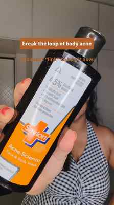 #AD I thought my body acne was hormonal. Turns out it was ge