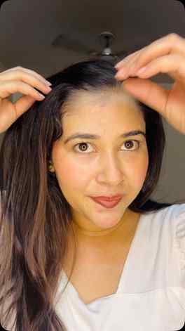 After using the WishCare Hair Growth Serum, here’s my honest