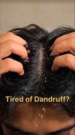 Best way to control dandruff ✨📈 for men
Looking for an ant