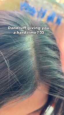 ✨ Your daily dose of scalp care. 🌿💚
Give your scalp the ca