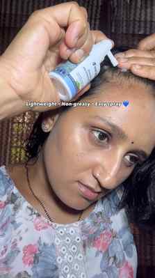 🔹My honest review of WishCare Hair Growth Serum
✨Hair fall 