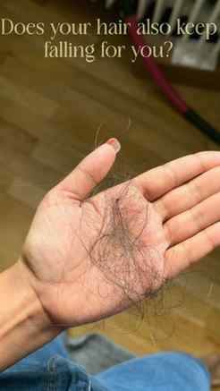 Is your hair is also the only thing that's falling for you �