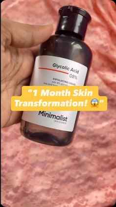 “1 Month Skin Transformation! 😱”#Skincare Malayalam#Pigme