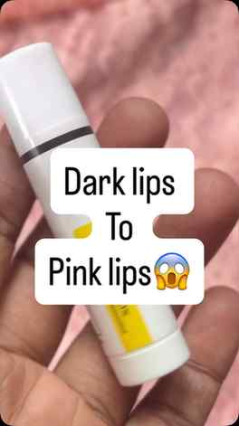 Dark Lips to Pink Lips ✨ Best Lip Balm for Pigmented Lips#Li