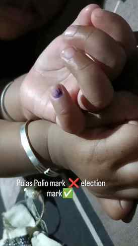 Pulas Polio ❌ election mark ✅🤣🤣🤣😂😂
Strong baby #cutetat