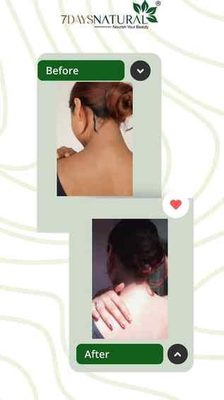 Neck & Back ka kaalapan? Not anymore!

 @7daysnatural.review