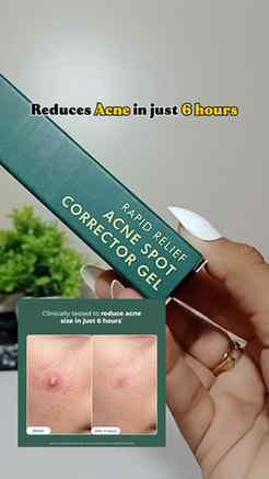 Reduces acne in just 6 hours ✨
Your skincare solution is he
