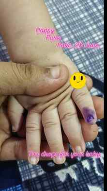 Needed two drops all the babies in the world
#pulse polio #